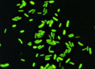 ابزاری که باکتری های مقاوم در برابر دارو را شناسایی می نماید